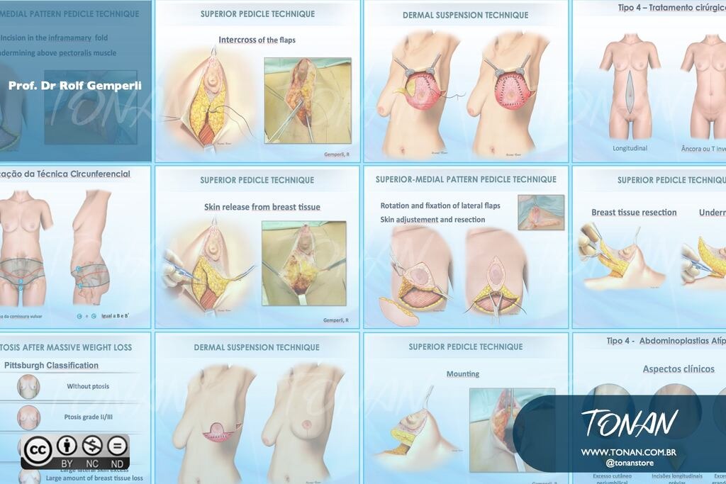 03 Tonan Aulasmedicas000004 AQEeveo5k8IQ7Jjw