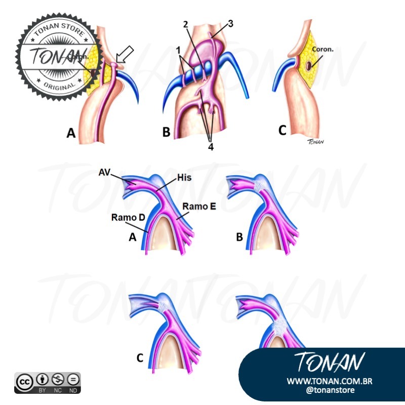Tonan Ilustracaomedica21 MxB201KRLoIoGZwD
