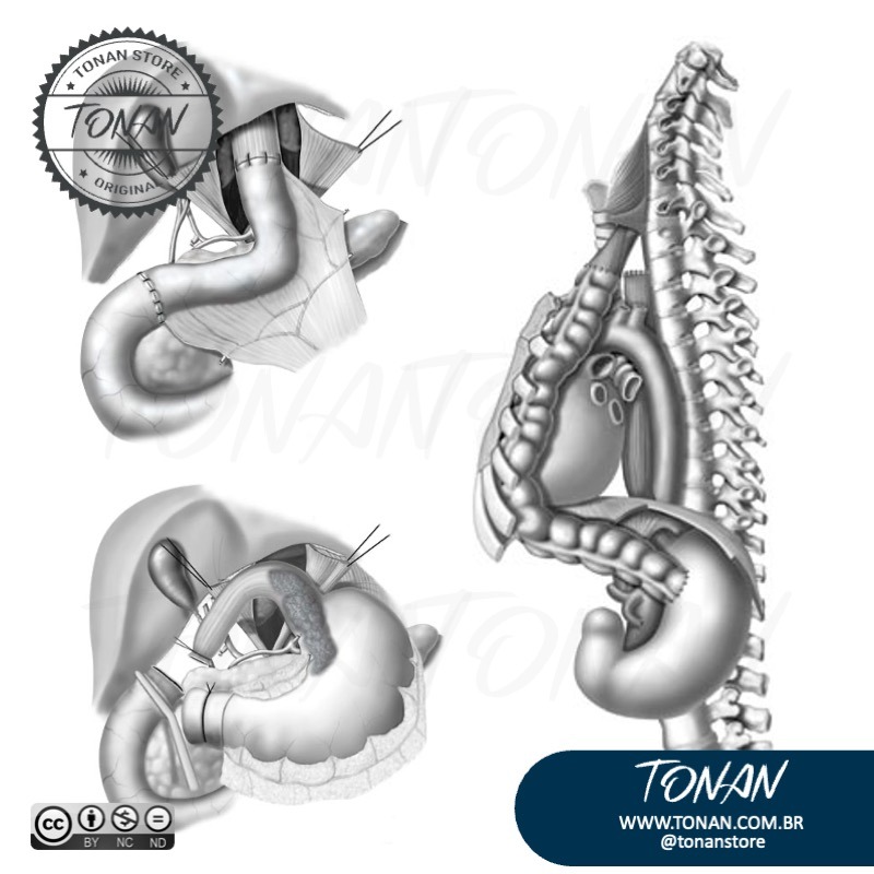 Tonan Ilustracaomedica25 Yg24gkKRZnFrJDg4