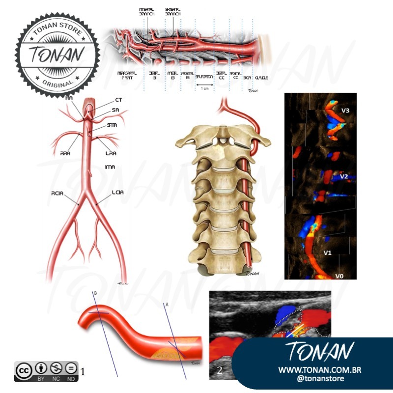 Tonan Ilustracaomedica26 M7VDBgXa4XFe1jM3