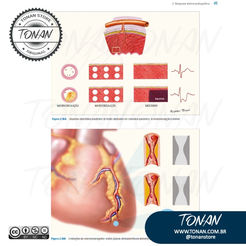 Tonan Ilustracaomedica3 Mv0P9yKGPQcDOBWK