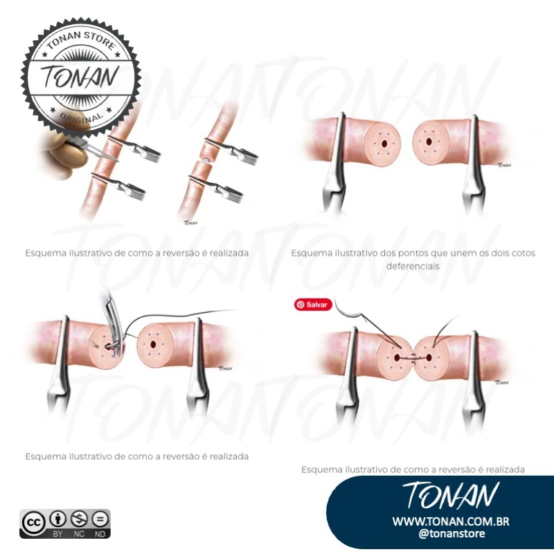 Tonan Ilustracaomedica31 Y4LP36X109Tjo15J