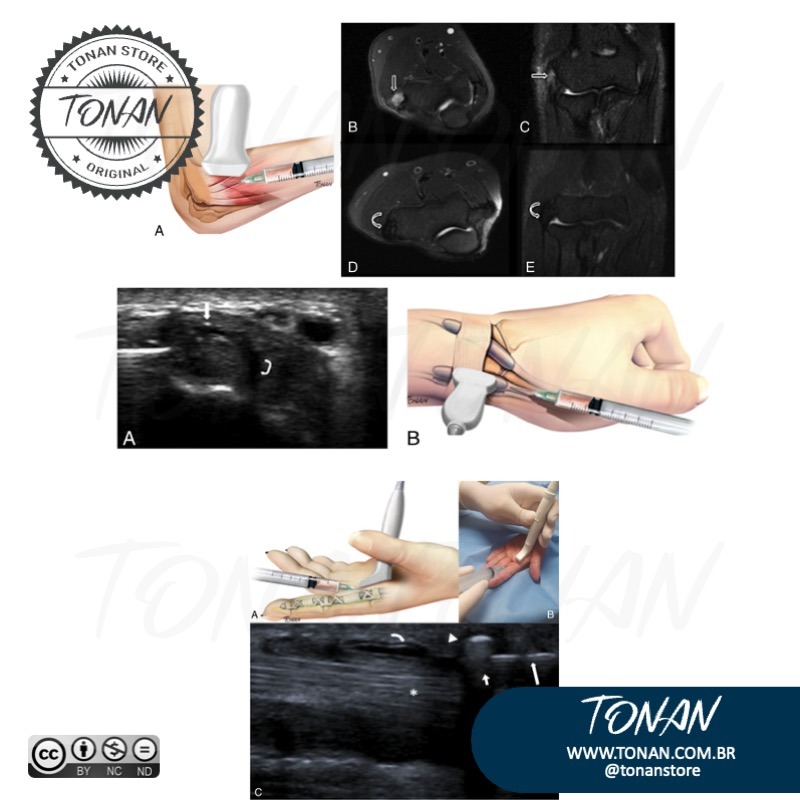 Tonan Ilustracaomedica34 YBgj5MX6avhXyMDj