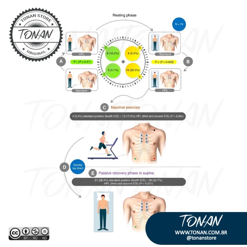 Tonan Ilustracaomedica4 Yle4zkKR2lu9bwwM