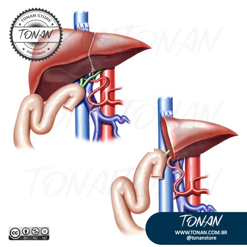 Tonan Ilustracaomedica40 AoP4zyKXVocZlkQV