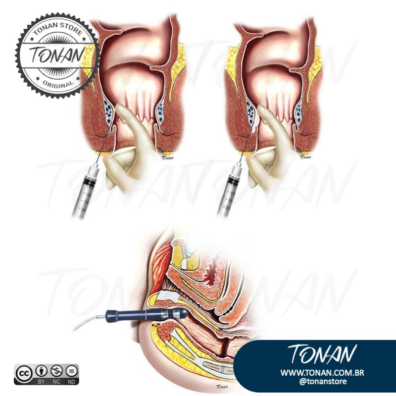 Tonan Ilustracaomedica41 AMqDMvg0LDIGlRRb