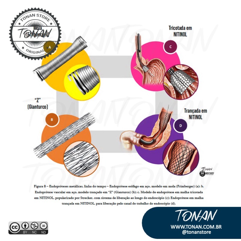 Tonan Ilustracaomedica42 DJoP8rgy1KS0DKbY