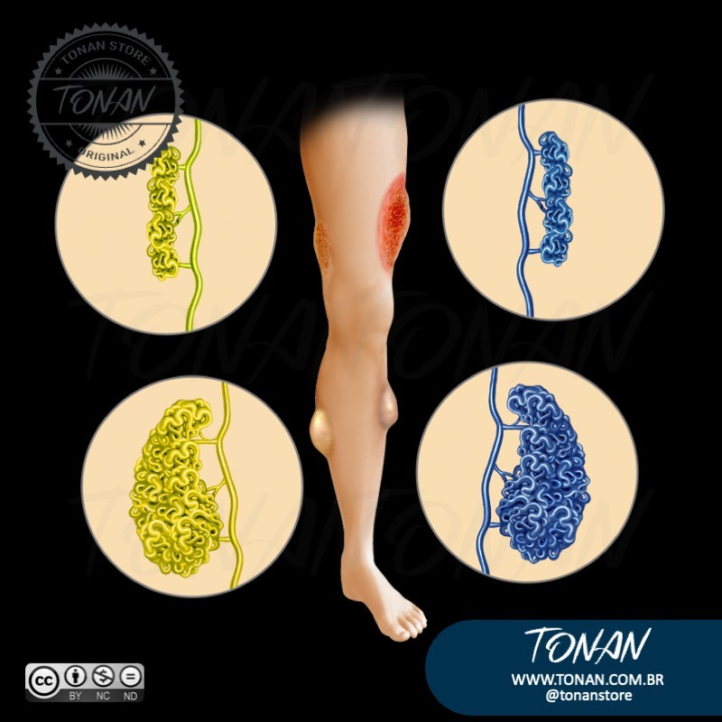 Tonan Ilustracaomedica43 DOqZ36gVJMTOnzqy