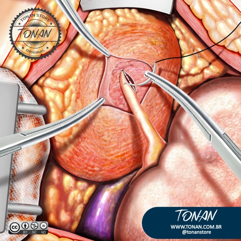 Tonan Ilustracaomedica45 A3QlZKV36MuwDg97