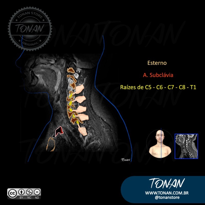 Tonan Ilustracaomedica47 YZ9El0g3zpFEG9yO