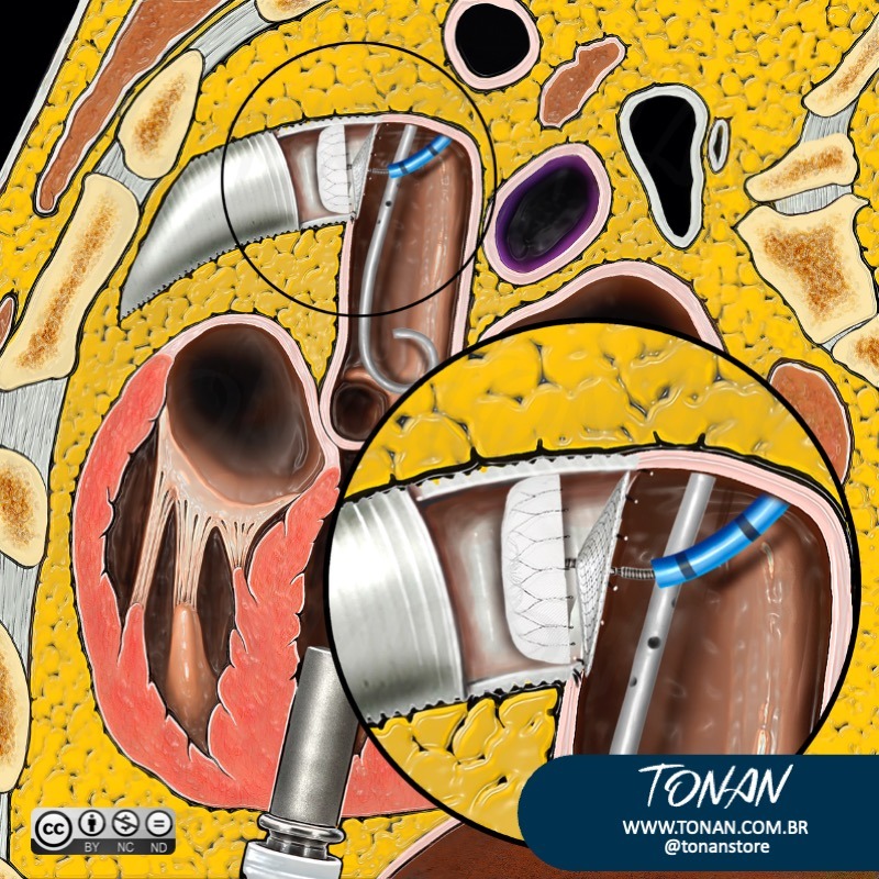 Tonan Ilustracaomedica48 AE07OXgL3xfLNNaX