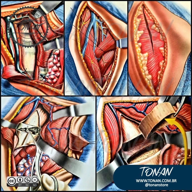 Tonan Ilustracaomedica51 M7VDBgXlzkCQyez8