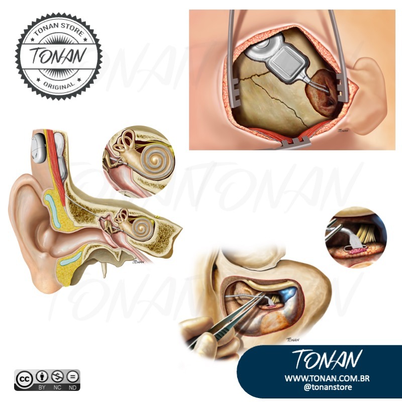 Tonan Ilustracaomedica55 Mv0P9yKgbgHEBqlk