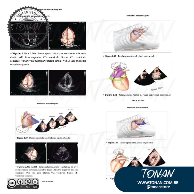 Tonan Ilustracaomedica58 Mv0P9yKGNLTKN1We