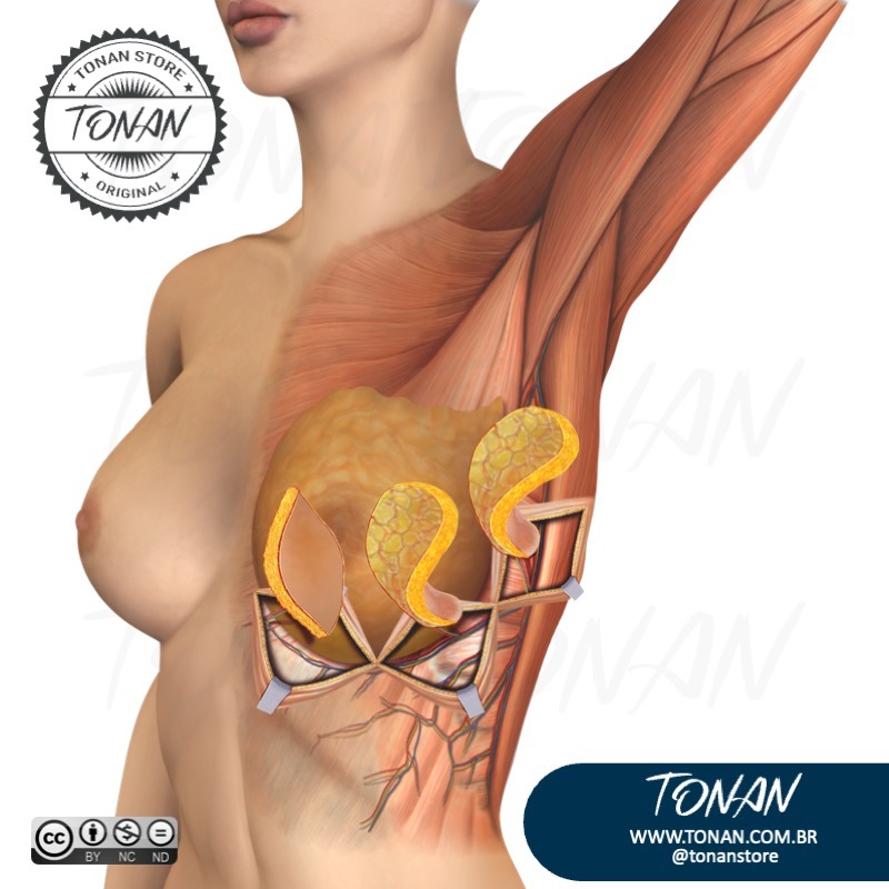 Tonan Ilustracaomedica6 Y4LP36X1JjIGBbeE