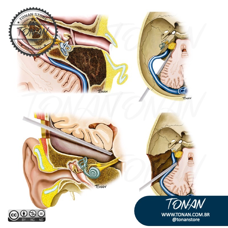 Tonan Ilustracaomedica60 MePg0kK7paS2LEqJ