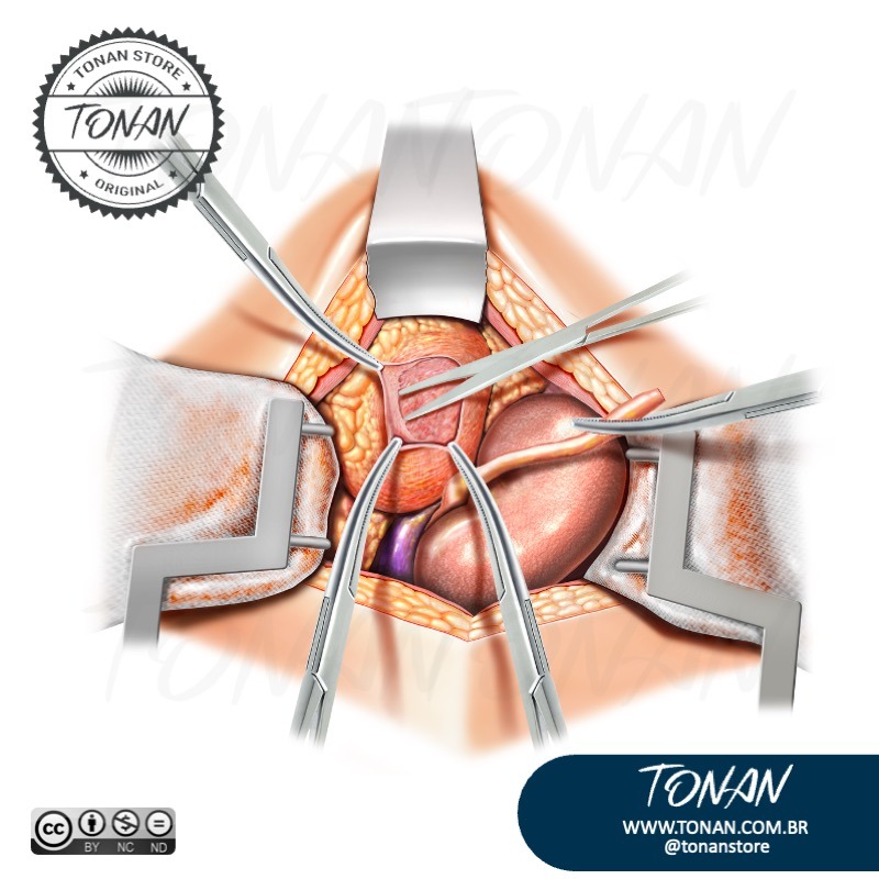 Tonan Ilustracaomedica7 Yg24gkKz1QuryBan