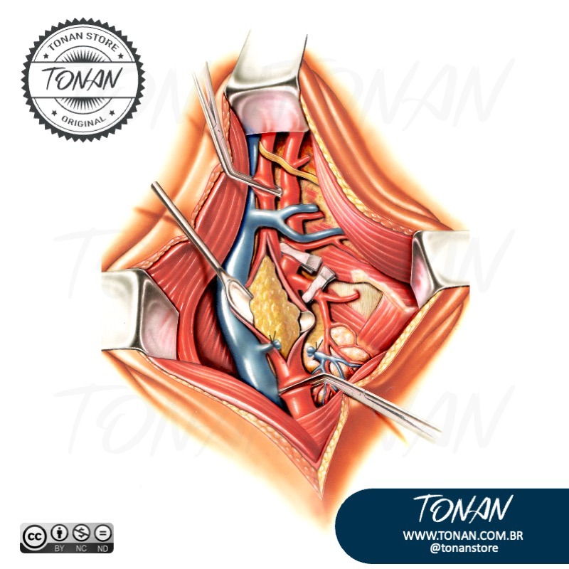 Tonan Ilustracaomedica8 Yan03DKL71slWRBo
