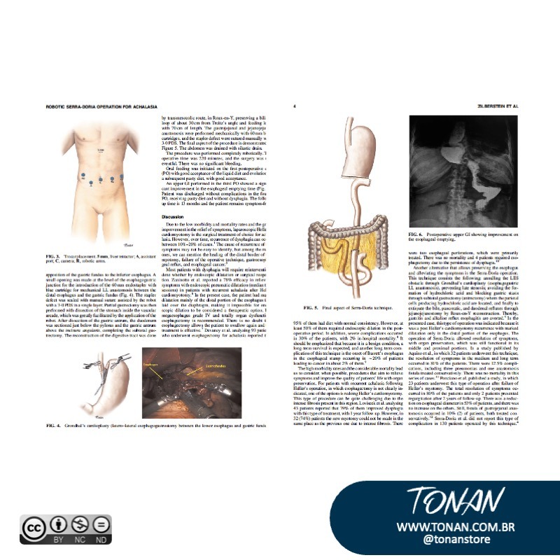 Tonanstore14 YX4jGL8WG2TXWlyD
