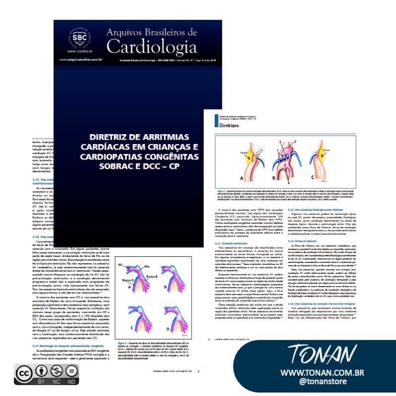 Tonanstore15 Yan03ZWO3vTDwMNV