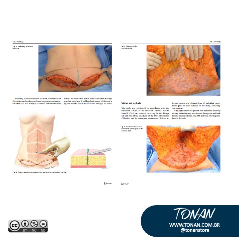 Tonanstore19 YKb82v0volt9nkyO