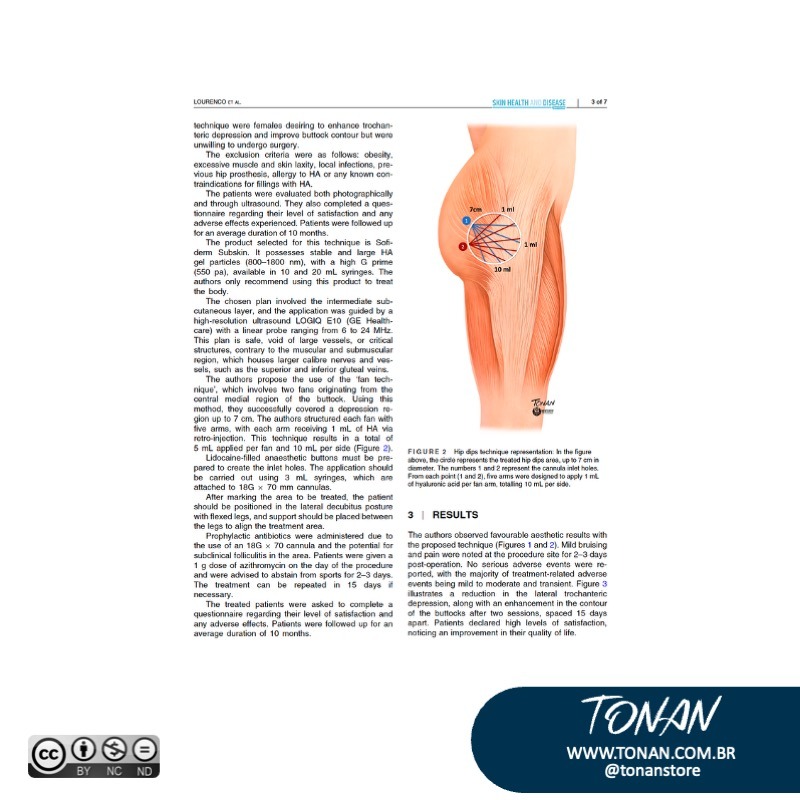 Tonanstore28 Awv8X5QEg9Cer7gE