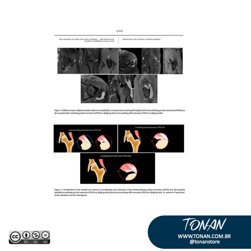 Tonanstore31 YD0EagOn3zUlngRV