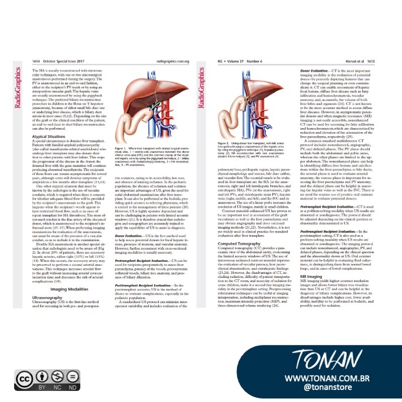 Tonanstore35 YbN4eX3Ovji5zjGK