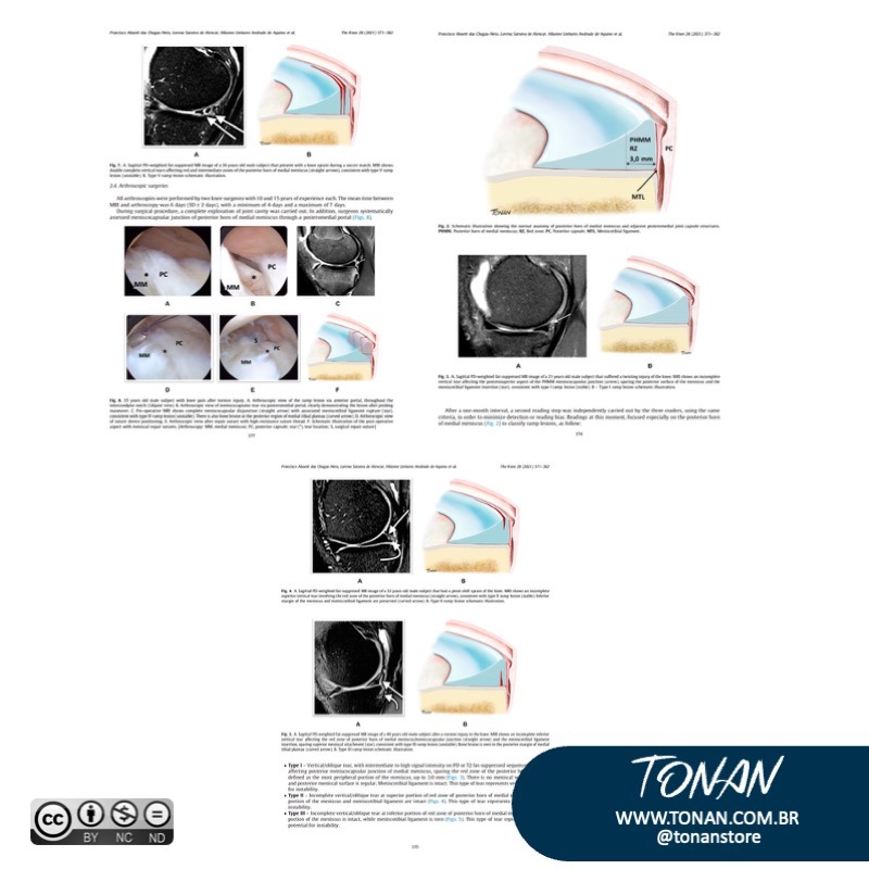 Tonanstore36 Mp84zokzzRuW2Kwy