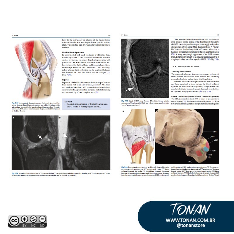 Tonanstore40 M5K8eDjp4LIV6LNk
