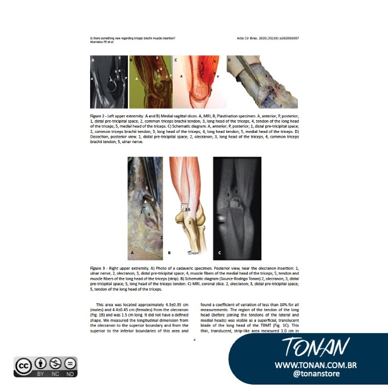 Tonanstore41 Aq2GzQlzGLiX6Mr3