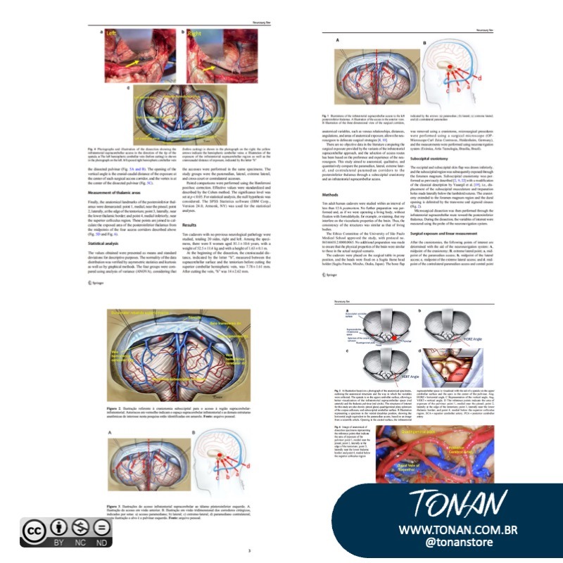 Tonanstore42 YD0EagOakJIWJrrV