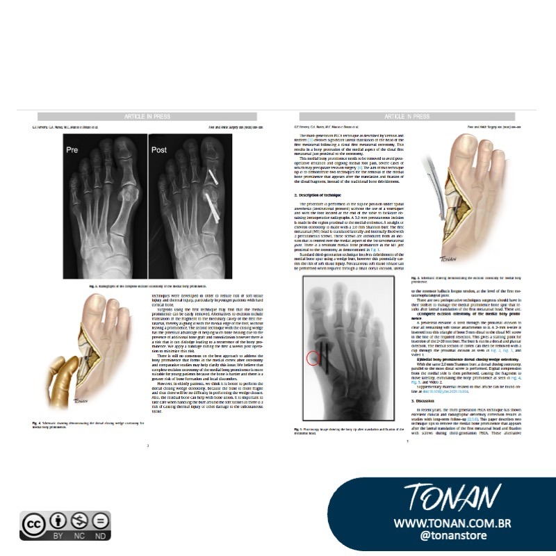 Tonanstore45 AE07OyVOP7sXQLJP