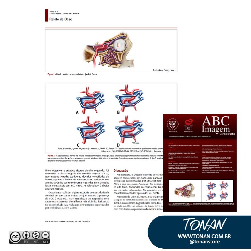 Tonanstore46 YrD4zQP9Xgszy21B