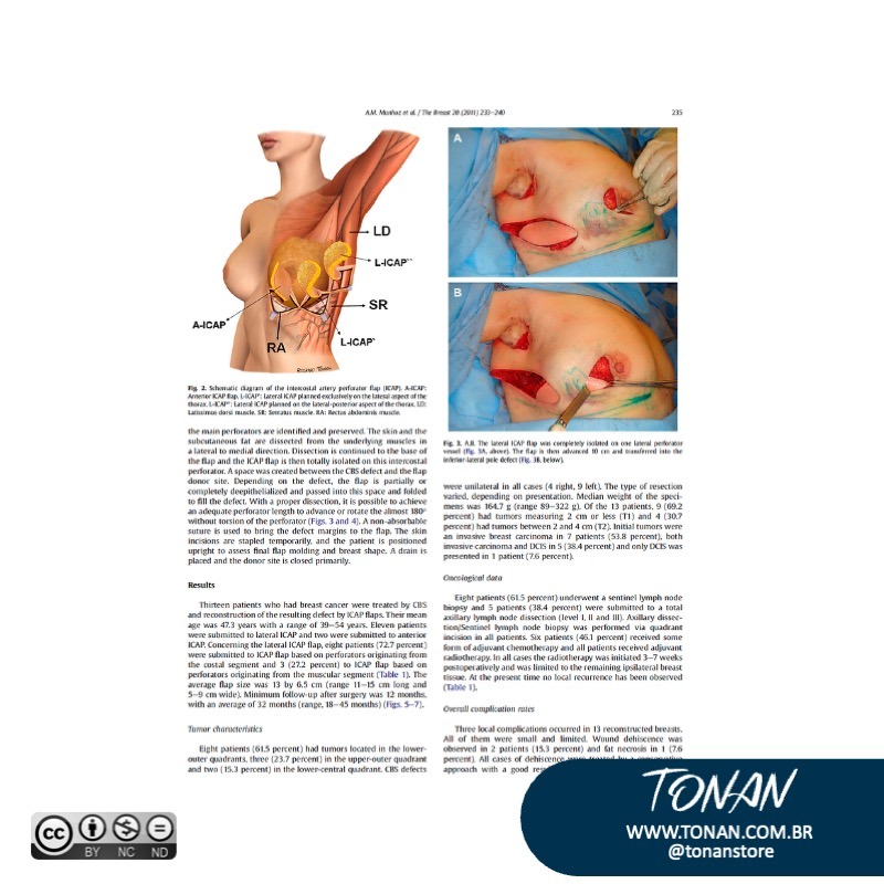 Tonanstore47 YZ9ElNPlOqIG1K0O