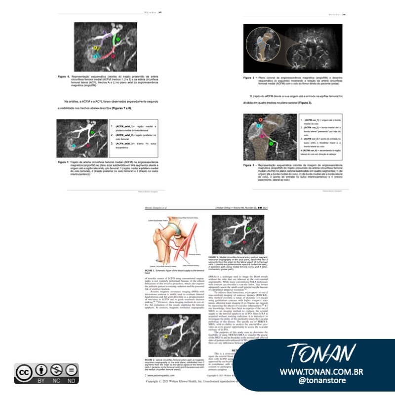 Tonanstore48 Yle4zNEzNvF958V2