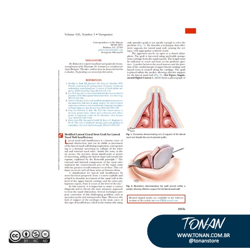 Tonanstore56 YbN4eX3No6IvO6a7