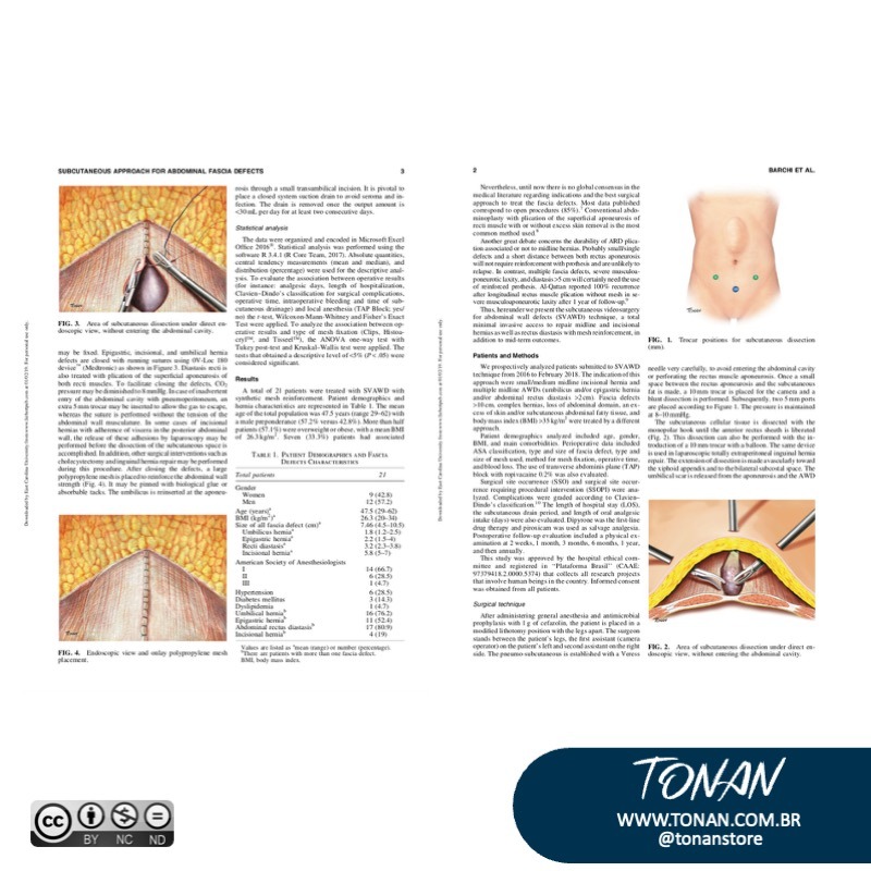 Tonanstore60 Mv0P9Q39o9CvPNJy