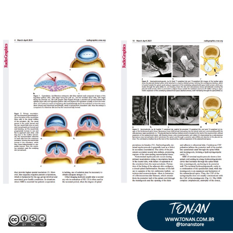 Tonanstore62 Yg24gXGOKytpoKG9
