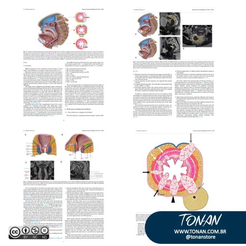 Tonanstore63 M6L2oMKq4jFynNw2
