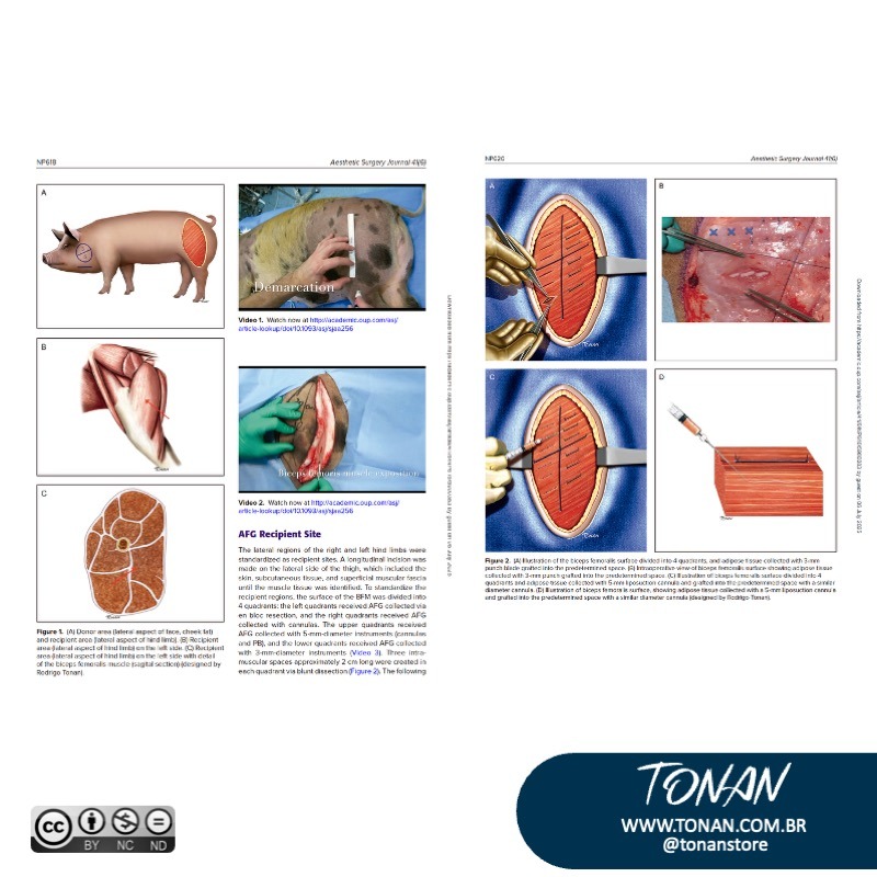 Tonanstore68 YKb82v0LlzcPM96r