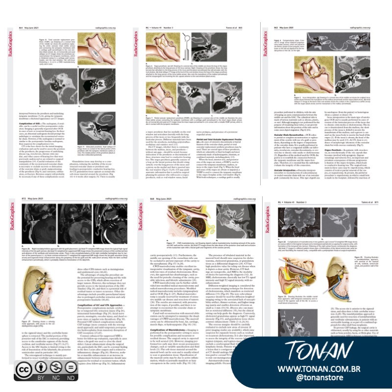 Tonanstore70 Yg24gXGO4qt28g4O