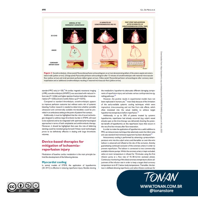 Tonanstore72 Mnl4zENZ4LCy45Zl