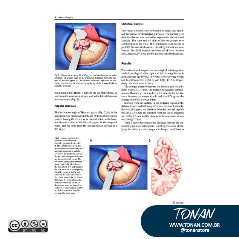 Tonanstore73 AQEeGj0Ek1Sxv02W