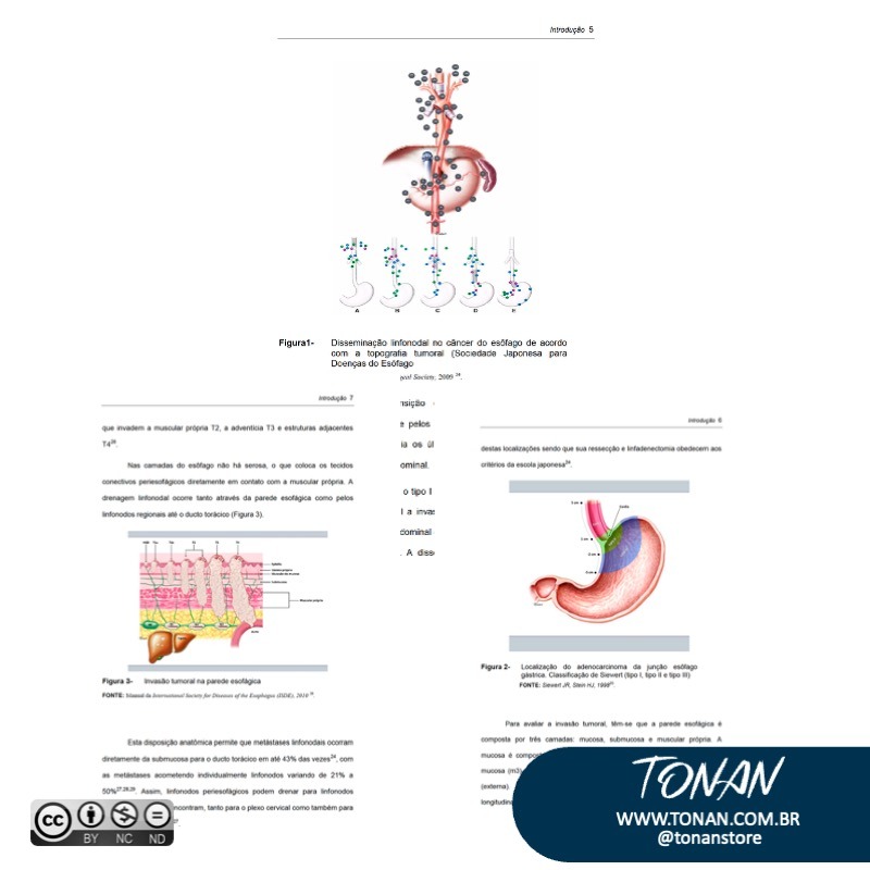 Tonanstore78 Yle4zNEz6DIywO18