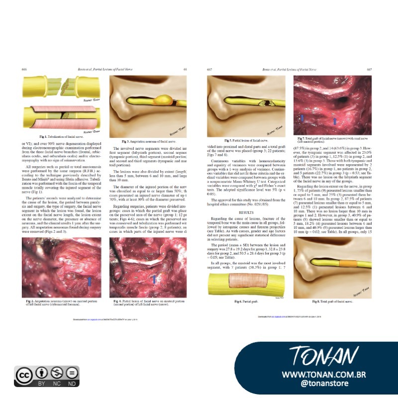 Tonanstore79 YBgj51qL7lf0BewL