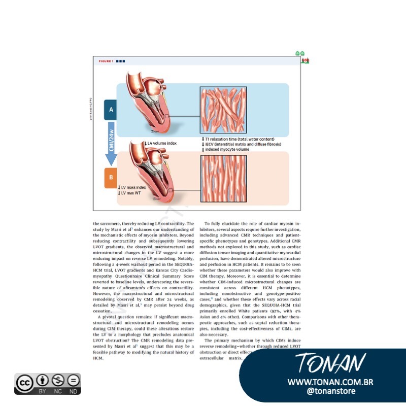 Tonanstore87 ALp2DLV0X3t55ez2