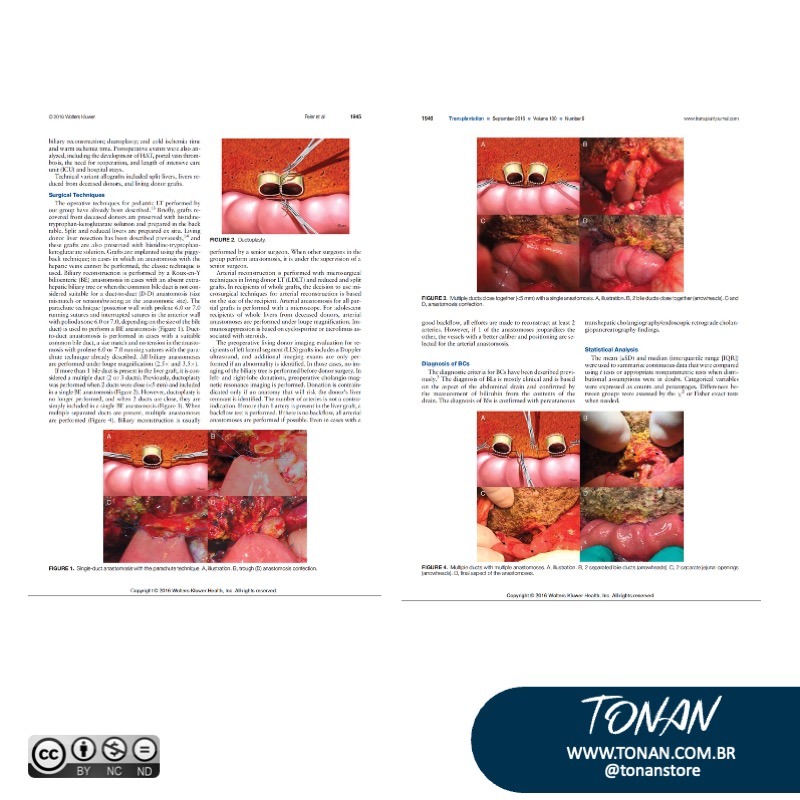 Tonanstore90 AzGMk0REP1SewNLP