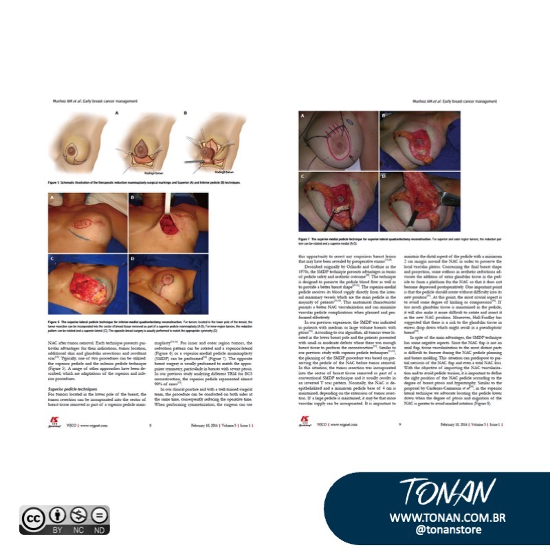 Tonanstore94 M5K8eDjKaXcWPJlZ